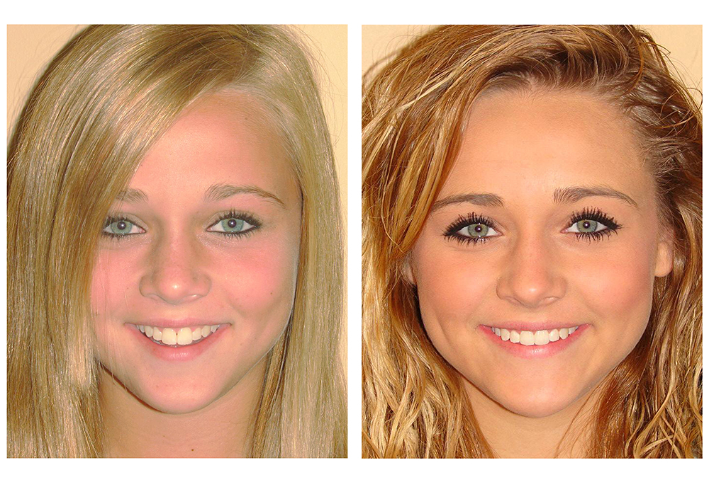 Springfield Gentle Dental