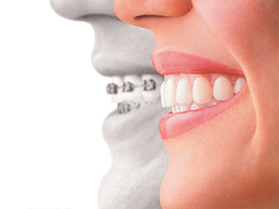 Springfield Gentle Dental | Extractions, Cosmetic Dentistry and Dental Bridges