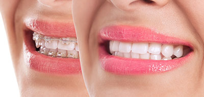 Springfield Gentle Dental | Orthodontics, Emergency Treatment and Dental Cleanings