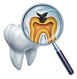 Springfield Gentle Dental | Dental Sealants, Dental Cleanings and Extractions