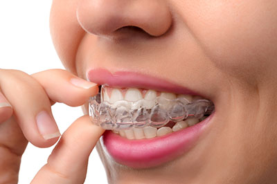 Springfield Gentle Dental | Orthodontics, Fluoride Treatment and Periodontal Treatment