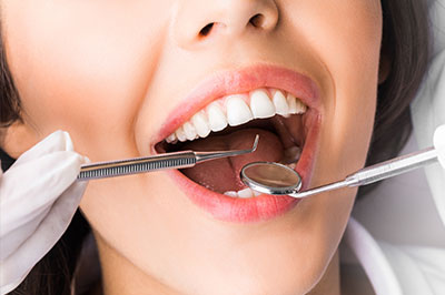 Springfield Gentle Dental | All-on-4 reg , Dental Fillings and Laser Dentistry